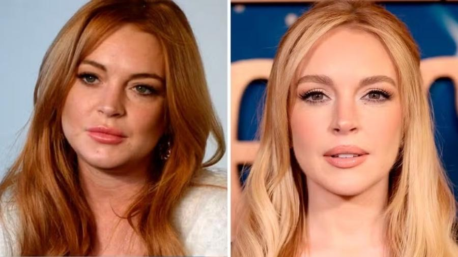 MICHAEL LOHAN NEGA CIRURGIAS PLÁSTICAS EM LINDSAY LOHAN: 